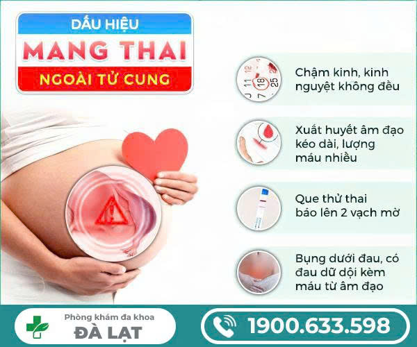 Hình ảnh minh họa